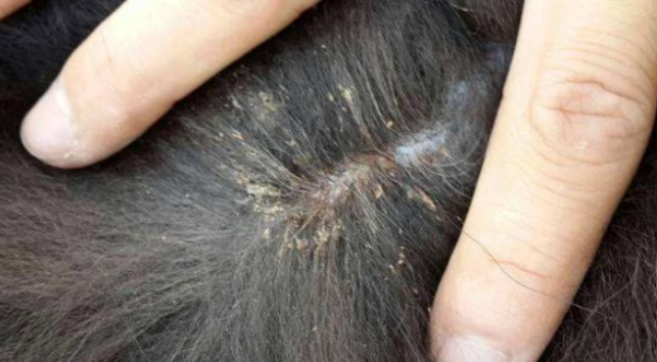What should I do if a hairy child has lice?